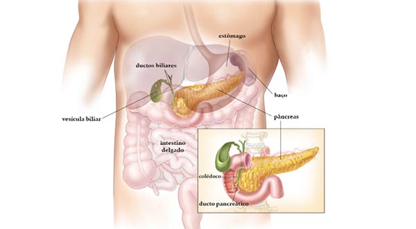 Pancreatite