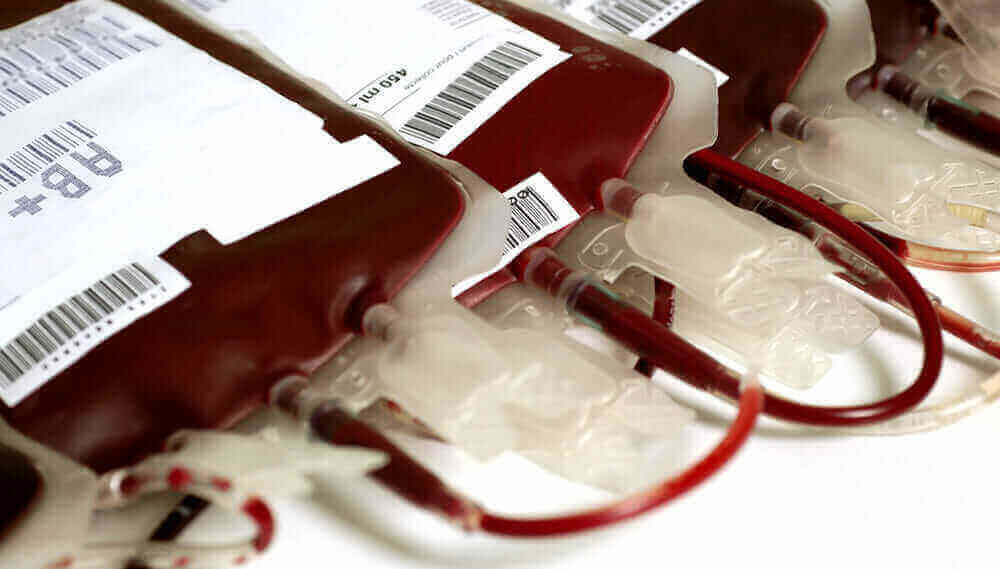 Sangramento Gastrointestinal